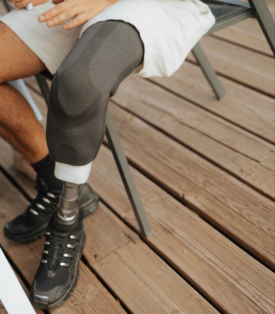 « Homme assis sur une chaise sur une terrasse en lames de bois, portant une prothèse à la jambe gauche.